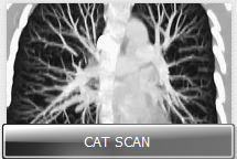 catscanthumb catscanthumb