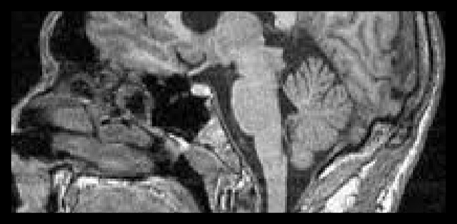 Neuroradiology Neuroradiology